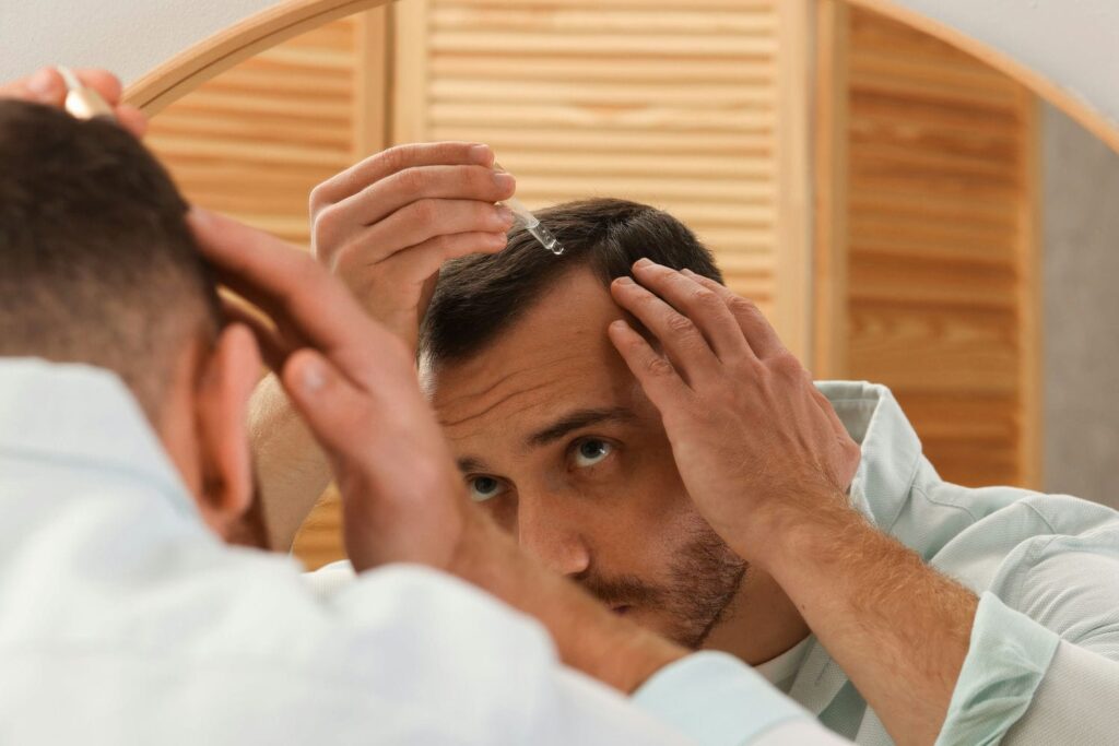 Man applying a topical hair loss treatment to his scalp in front of a mirror