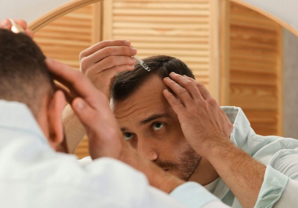 Man applying a topical hair loss treatment to his scalp in front of a mirror